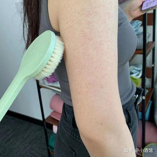 明星鸡皮肤,揭秘鸡皮肤背后的美丽